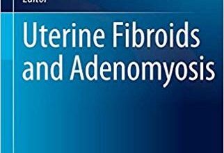 free-pdf-download-Uterine Fibroids and Adenomyosis (Comprehensive Gynecology and Obstetrics) 1st ed. 2018 Edition