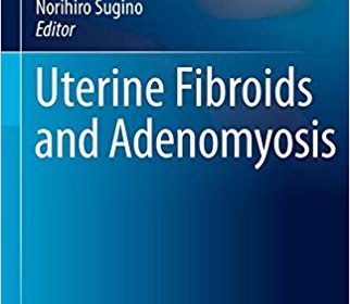 free-pdf-download-Uterine Fibroids and Adenomyosis (Comprehensive Gynecology and Obstetrics) 1st ed. 2018 Edition