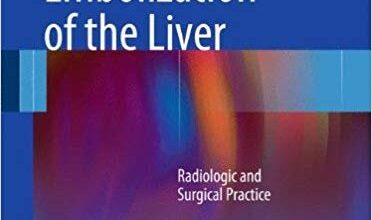 free-pdf-download-Venous Embolization of the Liver: Radiologic and Surgical Practice