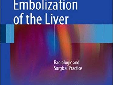 free-pdf-download-Venous Embolization of the Liver: Radiologic and Surgical Practice