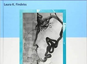 free-pdf-download-Venous Interventional Radiology