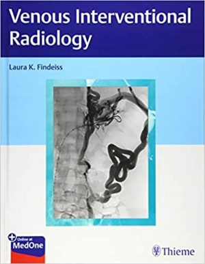 free-pdf-download-Venous Interventional Radiology