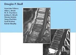 free-pdf-download-Vertebral Augmentation: The Comprehensive Guide