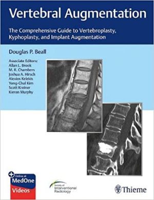 free-pdf-download-Vertebral Augmentation: The Comprehensive Guide