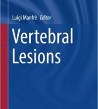 free-pdf-download-Vertebral Lesions (New Procedures in Spinal Interventional Neuroradiology) 1st ed. 2017 Edition