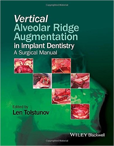 free-pdf-download-Vertical Alveolar Ridge Augmentation in Implant Dentistry: A Surgical Manual 1st Edition