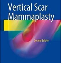 free-pdf-download-Vertical Scar Mammaplasty 2nd ed. 2018 Edition