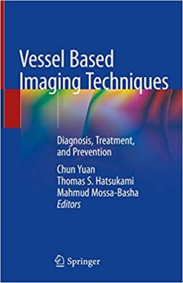 free-pdf-download-Vessel Based Imaging Techniques: Diagnosis