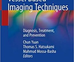 free-pdf-download-Vessel Based Imaging Techniques: Diagnosis