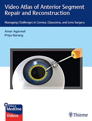 free-pdf-download-Video Atlas of Anterior Segment Repair and Reconstruction