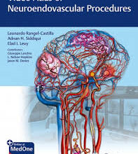 free-pdf-download-Video Atlas of Neuroendovascular Procedures Illustrated Edition