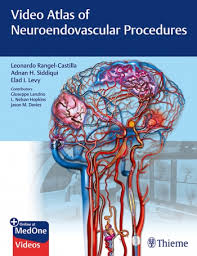 free-pdf-download-Video Atlas of Neuroendovascular Procedures Illustrated Edition