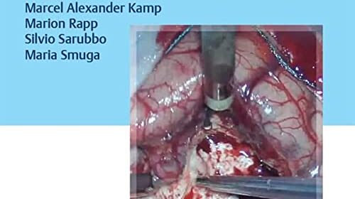 free-pdf-download-Video Atlas of Neurophysiological Monitoring in Surgery of Infiltrating Brain Tumors