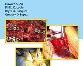 free-pdf-download-Video Atlas of Spine Surgery Illustrated Edition