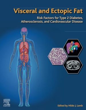 free-pdf-download-Visceral and Ectopic Fat: Risk Factors for Type 2 Diabetes