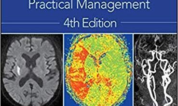 free-pdf-download-Warlow’s Stroke: Practical Management 4th Edition