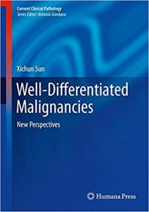 free-pdf-download-Well-Differentiated Malignancies: New Perspectives (Current Clinical Pathology)