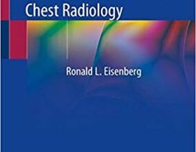 free-pdf-download-What Radiology Residents Need to Know: Chest Radiology