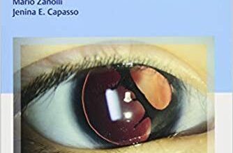 free-pdf-download-Wills Eye Handbook of Ocular Genetics 1st Edition