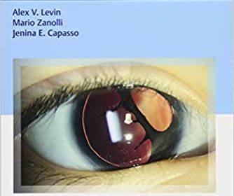 free-pdf-download-Wills Eye Handbook of Ocular Genetics 1st Edition