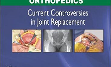 free-pdf-download-World Clinics Orthopedics: Current Controversies in Joint Replacement 1st Edition