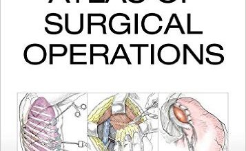 free-pdf-download-Zollinger’s Atlas of Surgical Operations